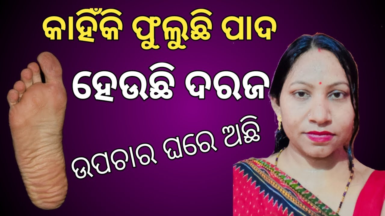 How To Releave Foot Pain At Home l Lalima Health Odia