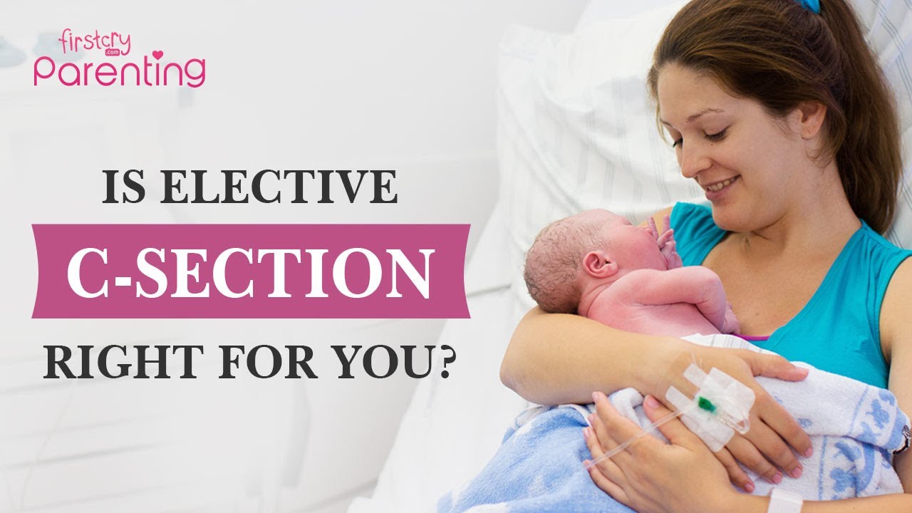 Should You Have an Elective C-Section?