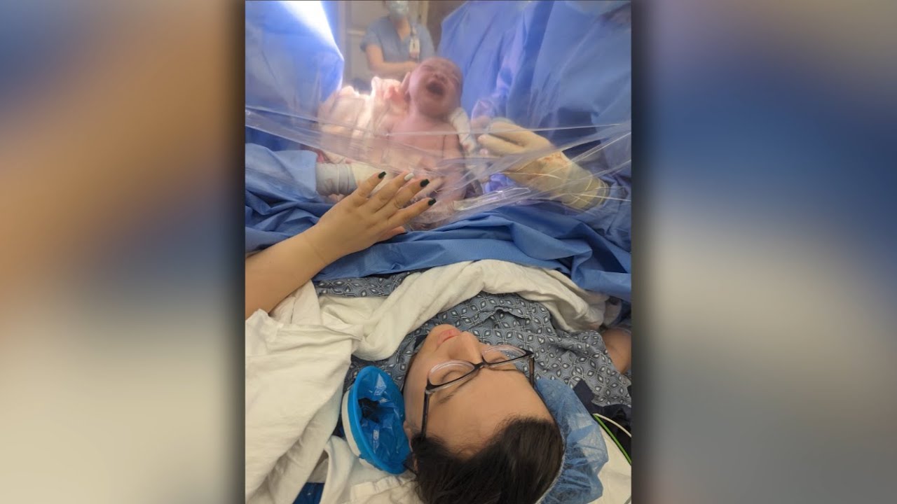 Unplanned C-section doubles risk of 'severe psychological stress' for new moms