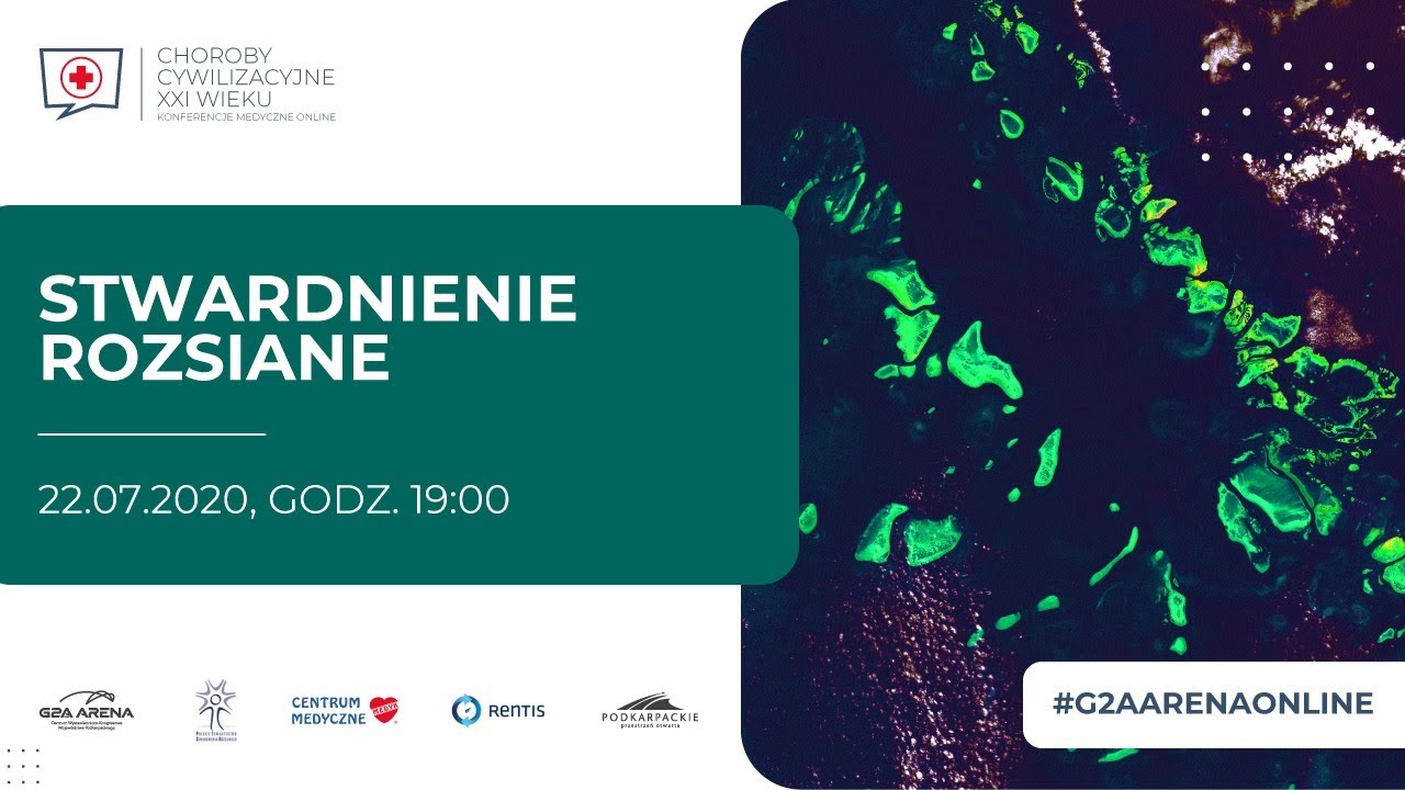 Stwardnienie rozsiane: 22 VII - live czat z neurologiem