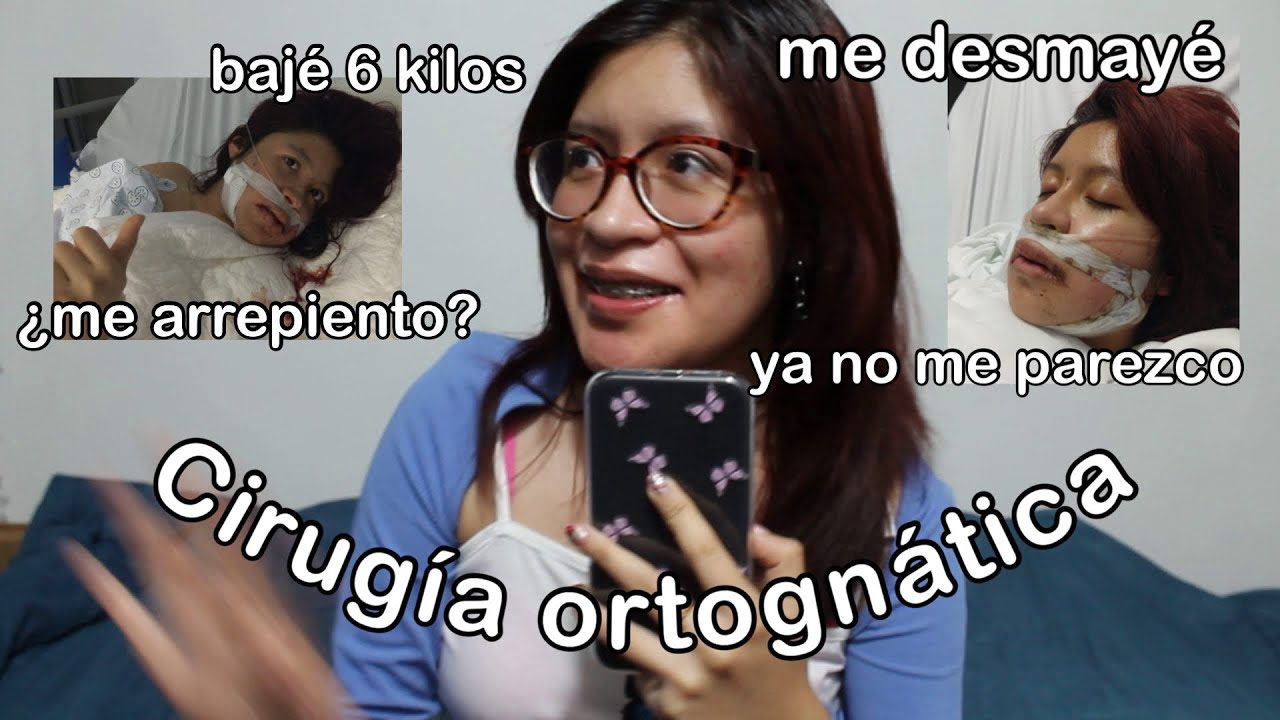 #Storytime: Mi EXPERIENCIA con la CIRUGÍA ORTOGNÁTICA | Me operé la mandíbula