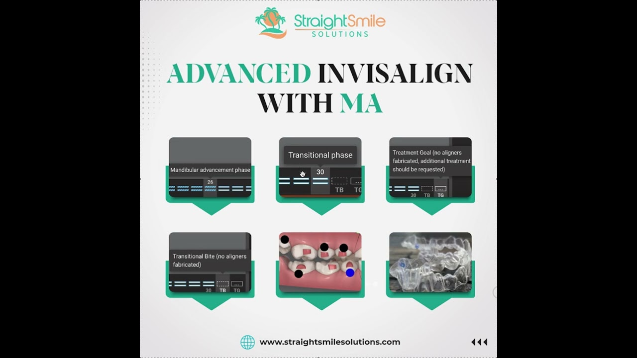 Advanced Invisalign with MA