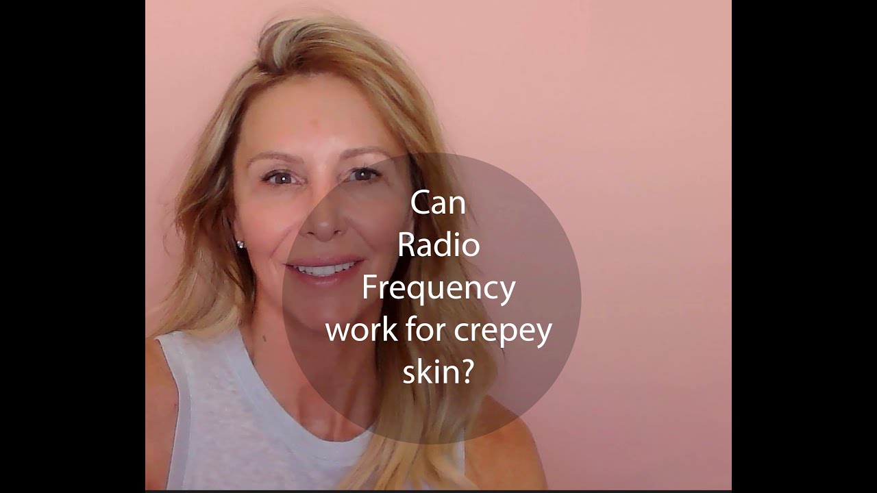 Radio Frequency and Crepey Skin