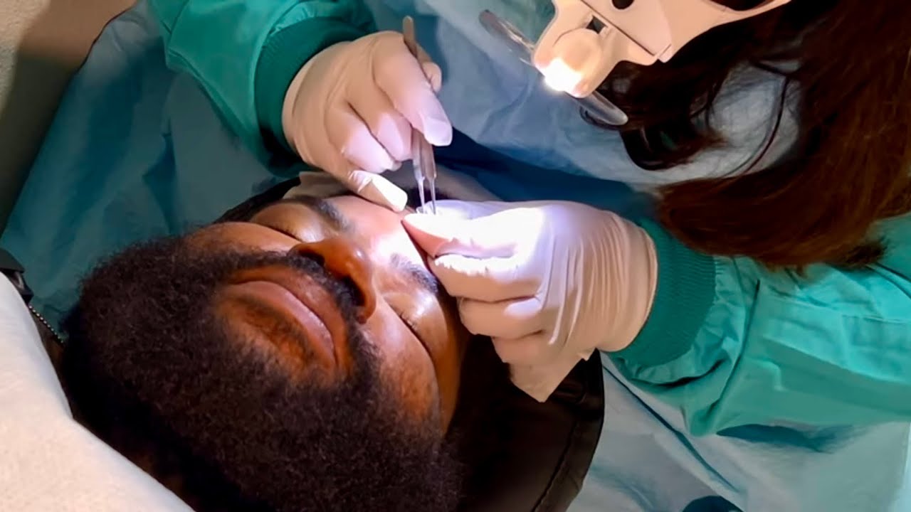 ASMR - Realistic “Unintentional” Skin Exam (Personal Attention, Plucking, Soft Spoken ASMR)