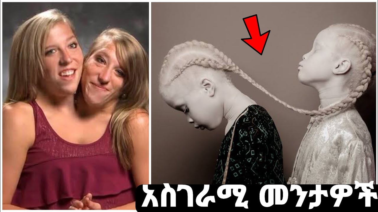 10 ለማመን የሚከብዱ  አስገራሚ መንታዎች