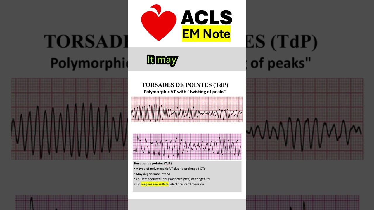 Torsades de pointes (TdP) #acls