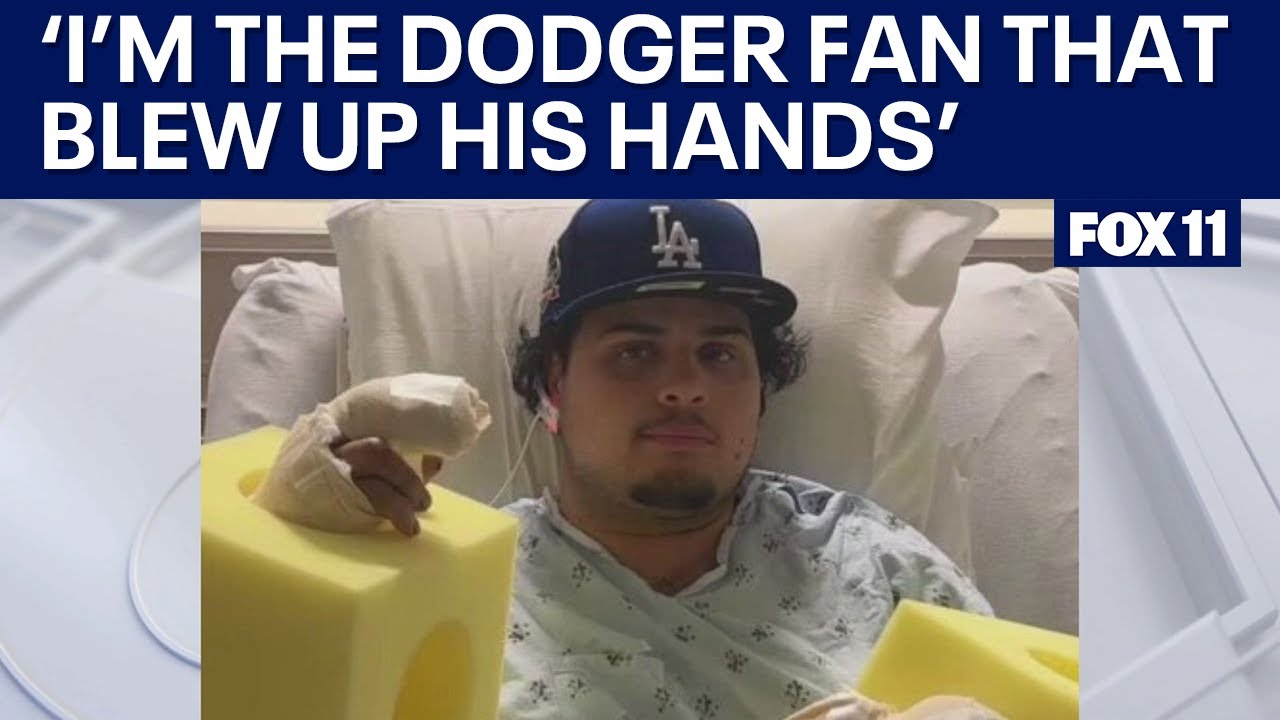 Dodgers fan loses fingers to firework and needs 3rd surgery, his dad says