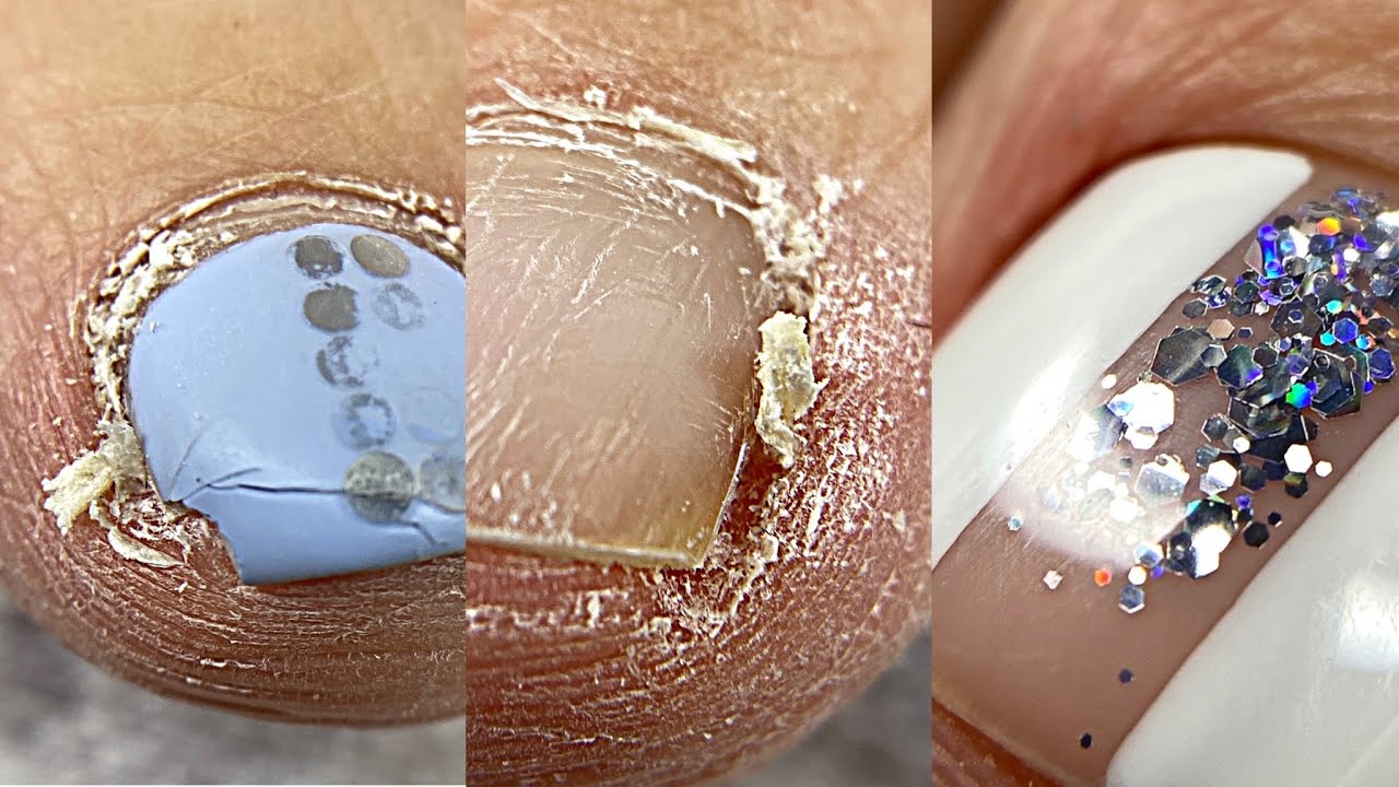 Как удалить подногтевую мозоль💅 Причины возникновения💅 Педикюр на клиенте