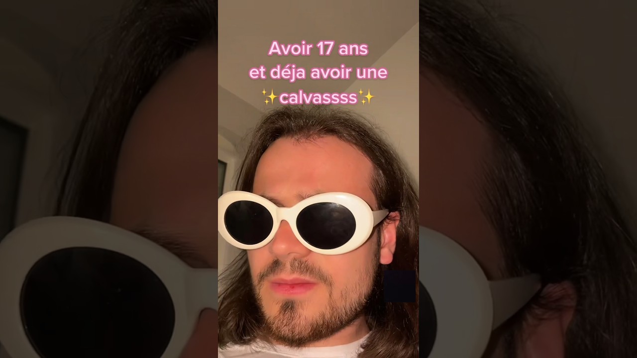 Avoir une calvitie à 17 ans