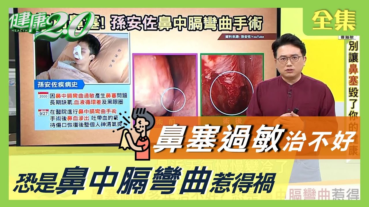 鼻塞 過敏 多年治不好？ 恐是 鼻中膈彎曲 惹得禍！ 三穴道有效緩解鼻塞 健康2.0 20201014 (完整版)