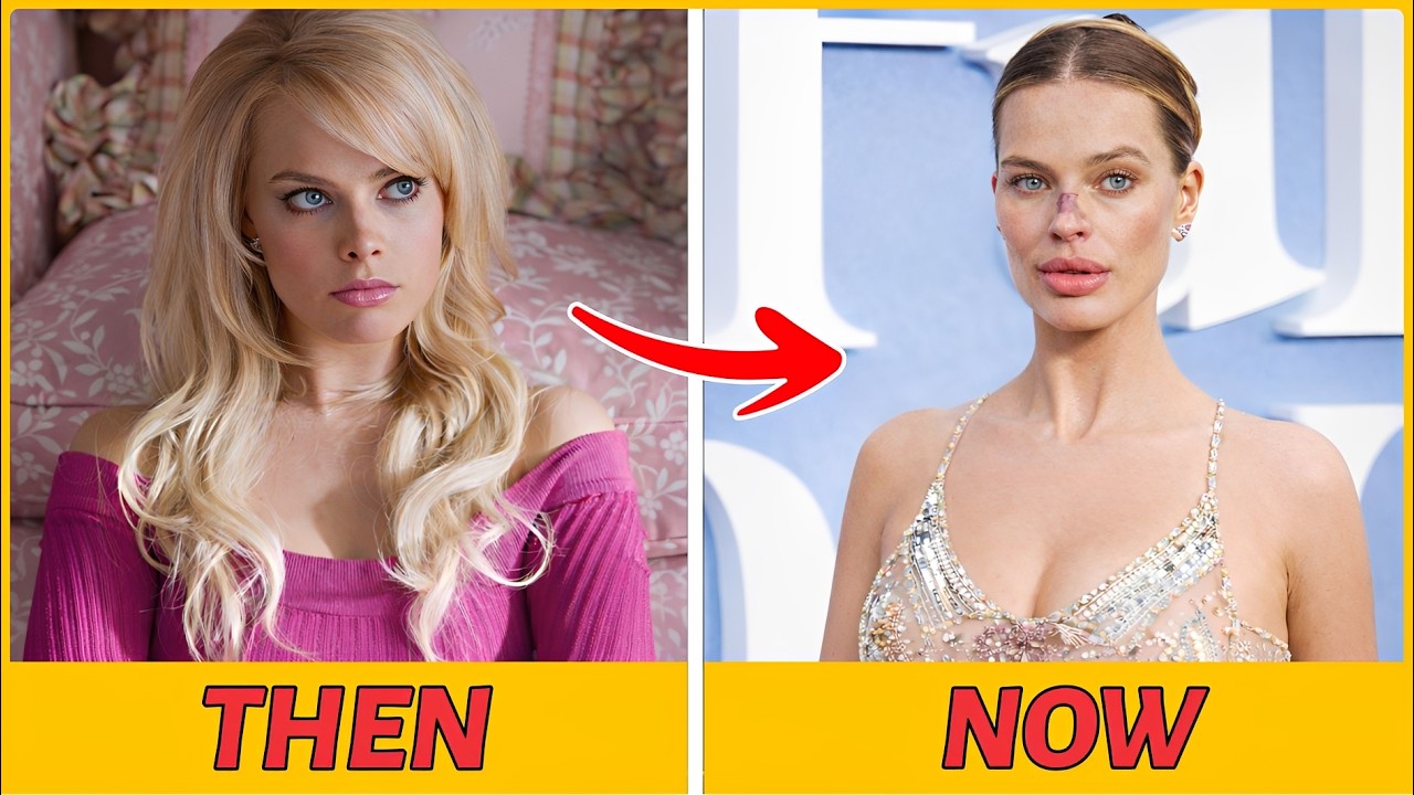 21 Celebrities With Plastic Surgery You Never Knew About
