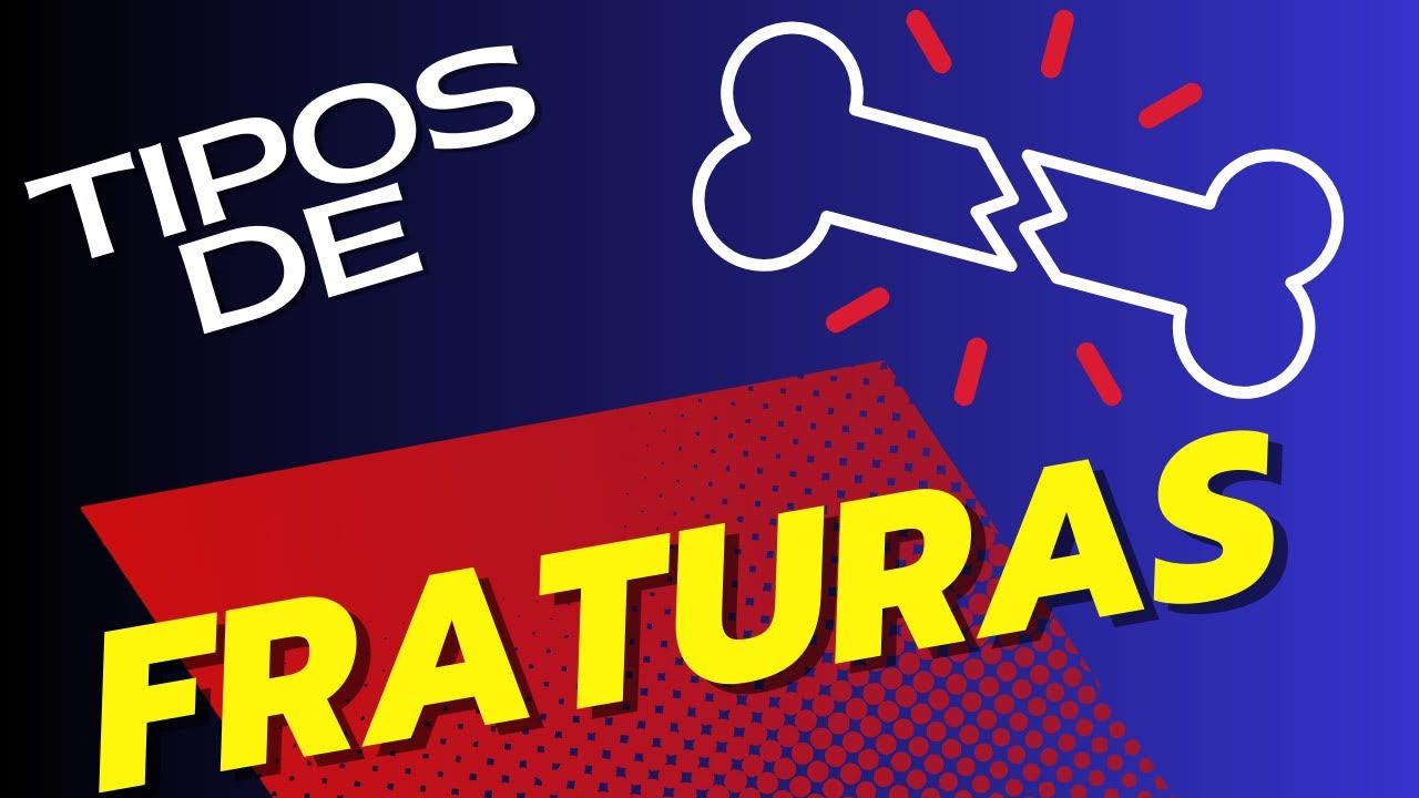Entendendo as fraturas &oacute;sseas: causas, tipos e diagn&oacute;sticos