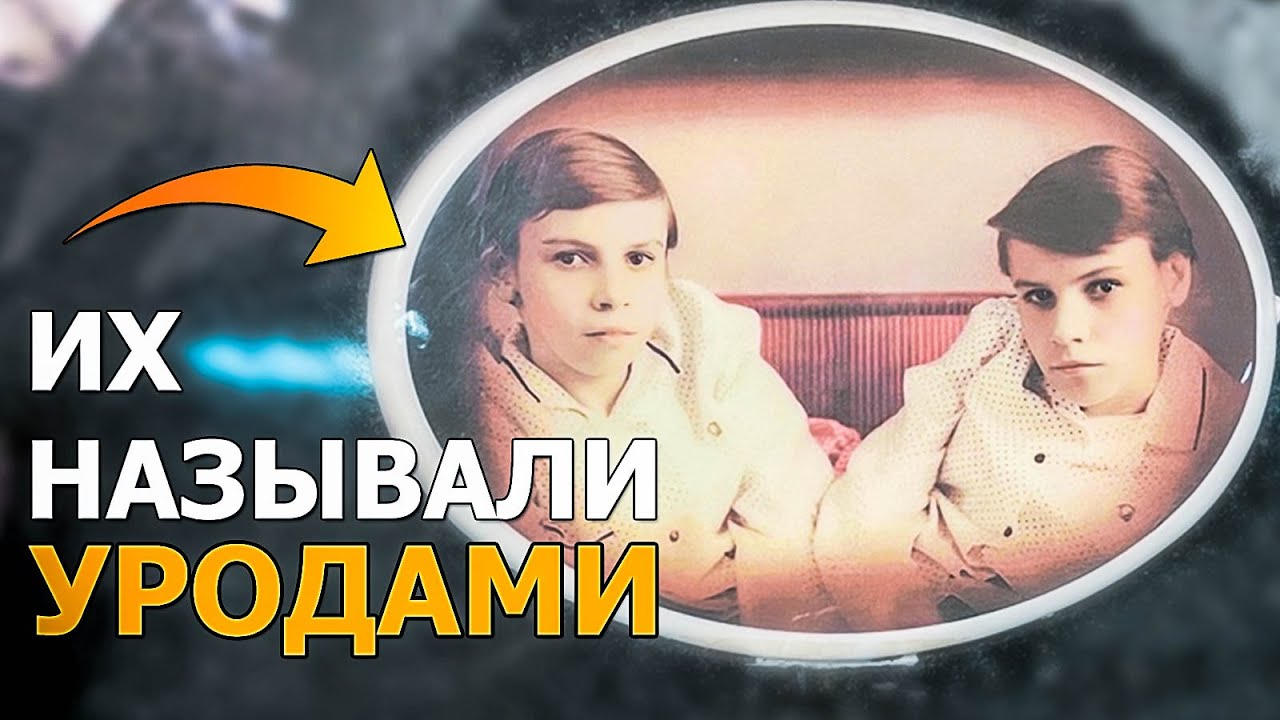 Страшная судьба знаменитых сиамских близнецов.