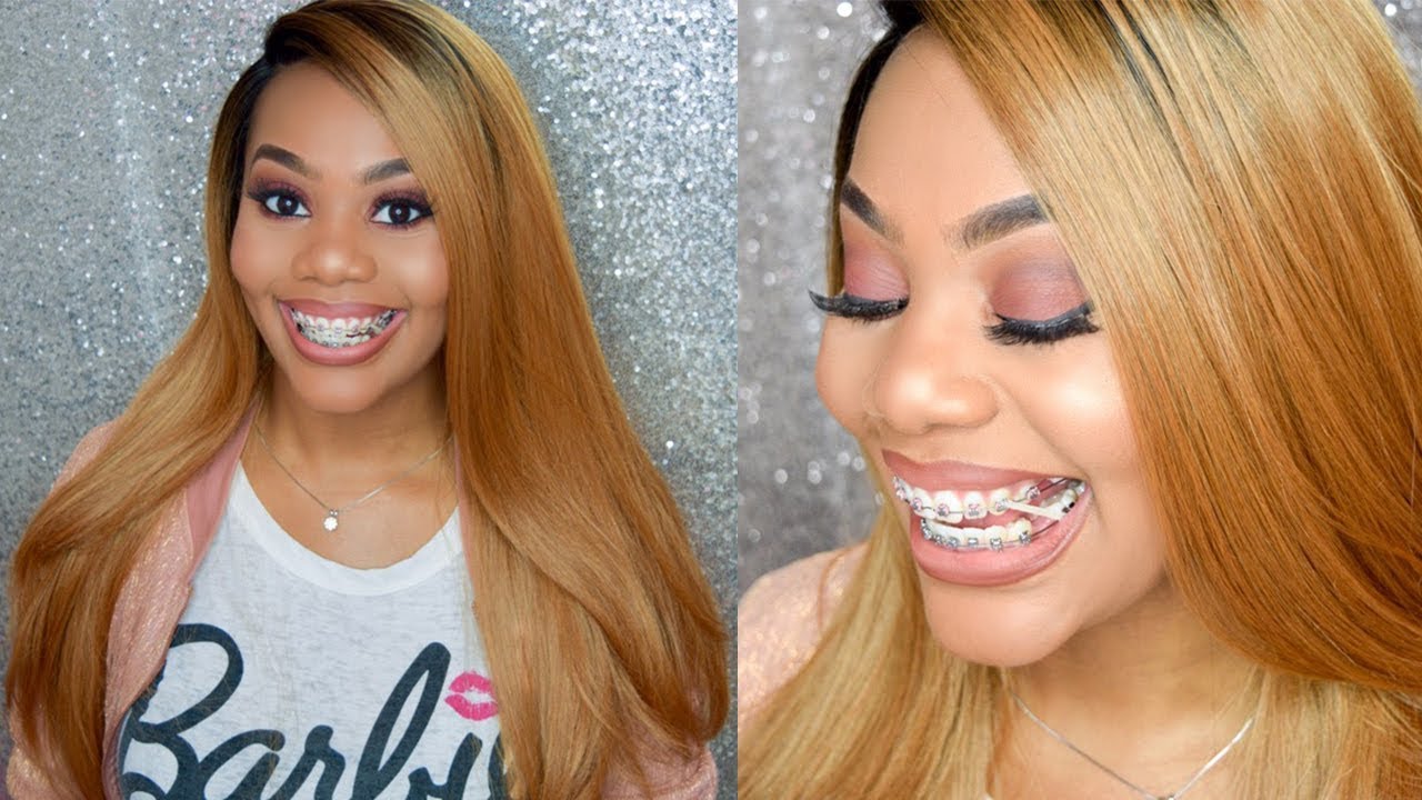 I got Elastics | Braces Update #2