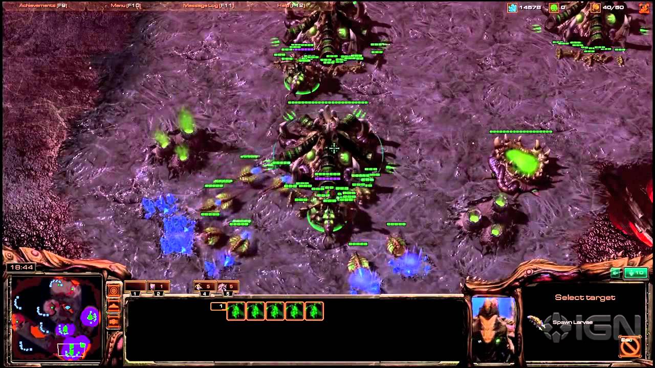StarCraft 2 Pro Tips: Backspace Inject