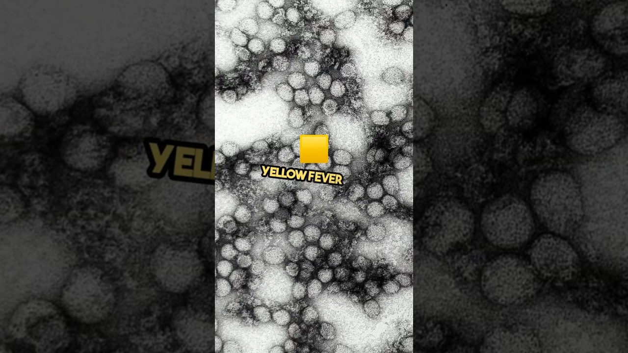 what the signs of yellow fever? #yellowfever #symptoms