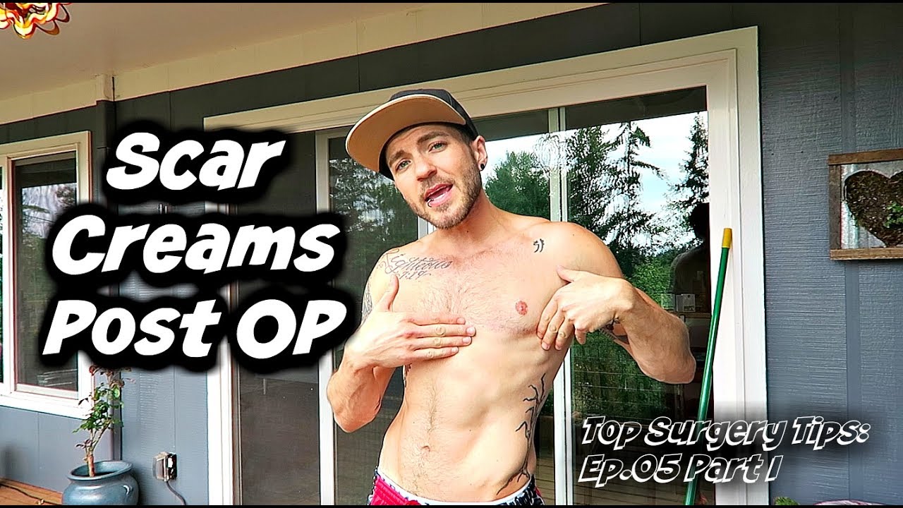 Top Surgery Tips Ep. 05: Part I- Scar Creams & Massage