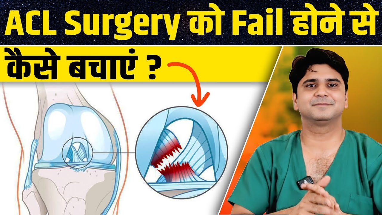 ACL Surgery को Fail होने से बचाना है तो ये 2 गलतियां कभी मत करना | Dr Neeraj Srivastava