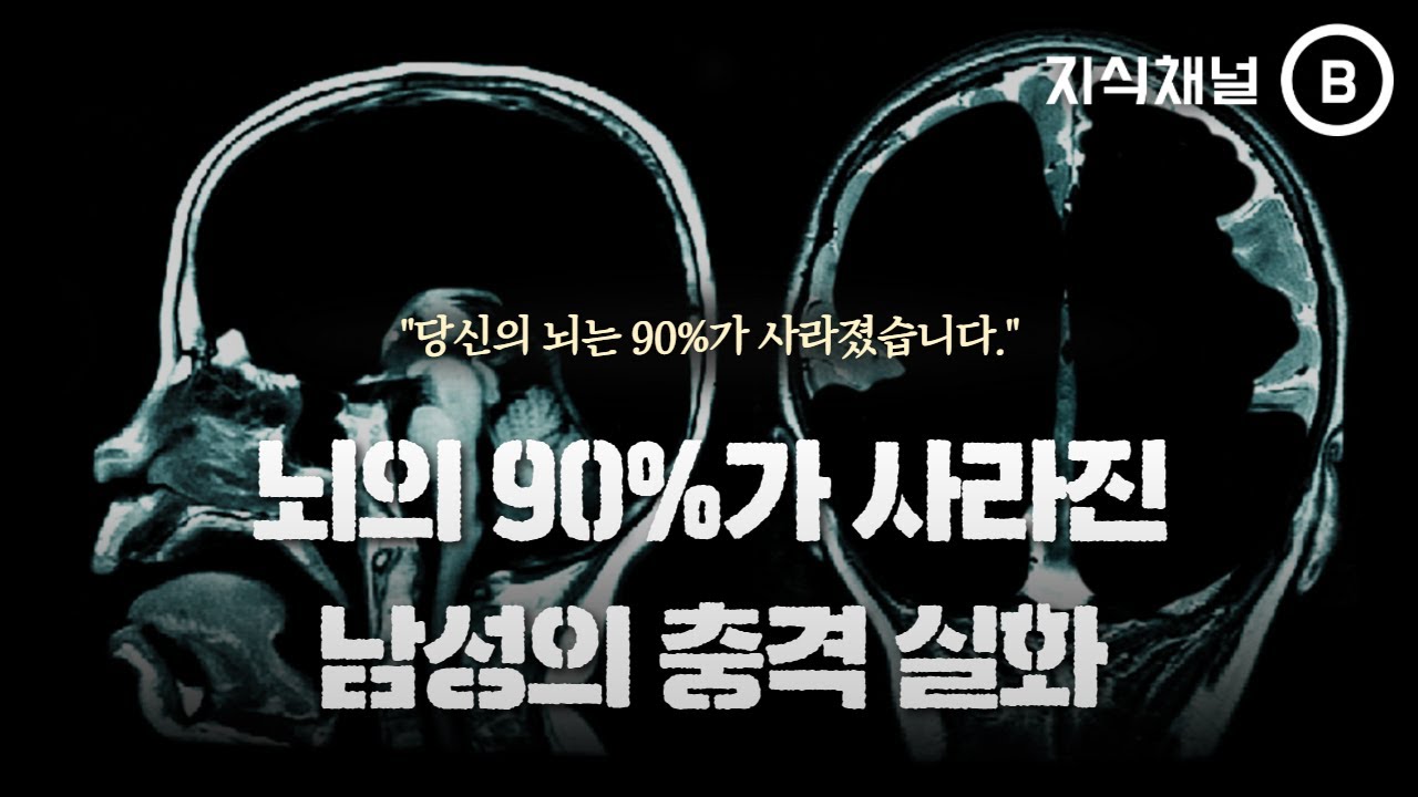 [지식채널 B] 뇌의 90%를 잃어버린 사나이