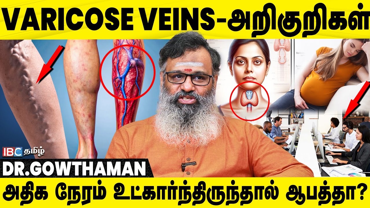 Варикозное расширение вен — простые способы лечения! | Шриварма Аюрведа | IBC Tamil
