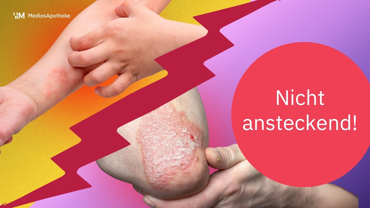 Haut unter Stress? Psoriasis & Neurodermitis erklären, erkennen, behandeln und entstigmatisieren!