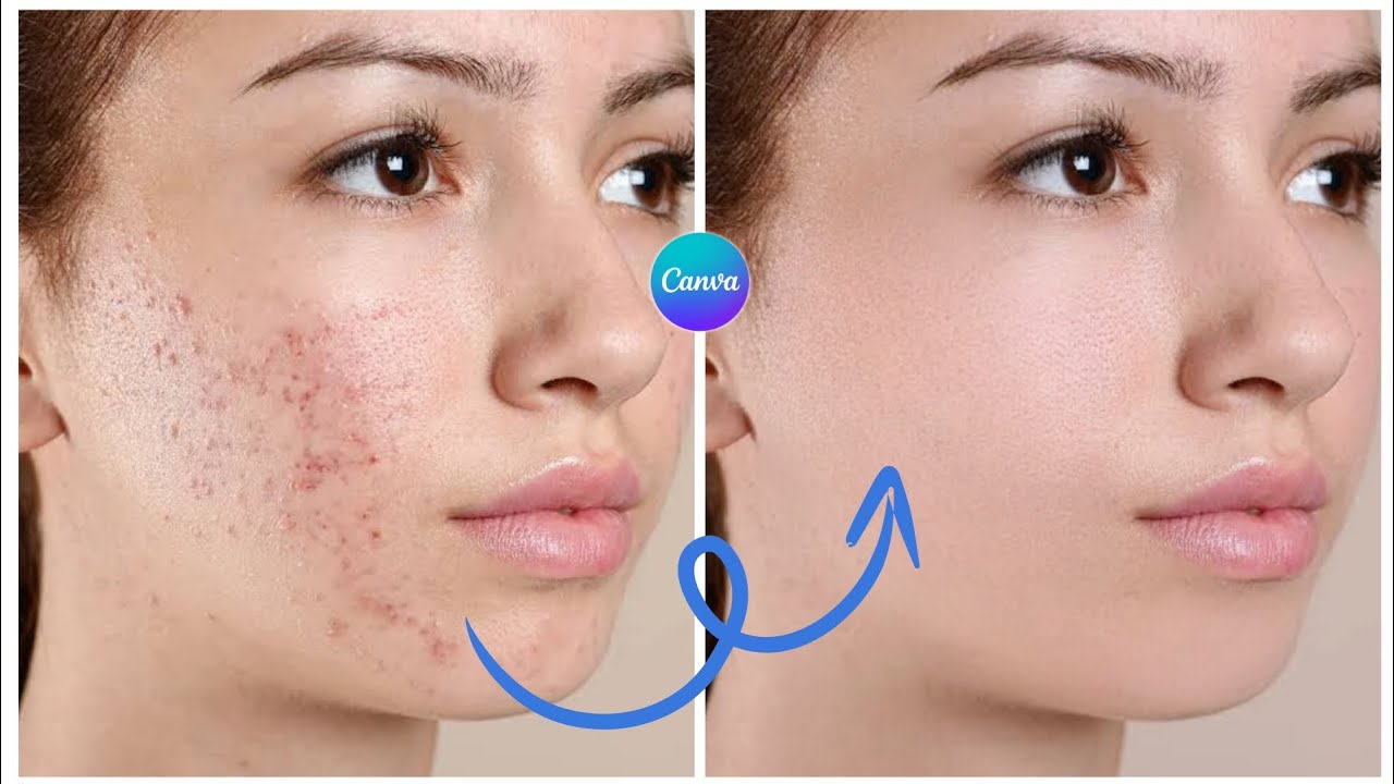 Face Retouching in Canva | Easy Photo Editing Tutorial