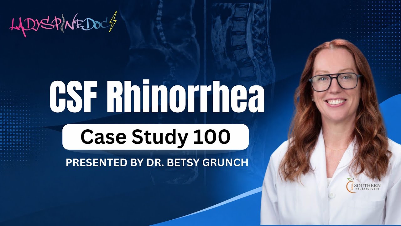 Case study 100 - CSF rhinorrhea EXPLAINED by neurosurgeon #casestudy #csfleak