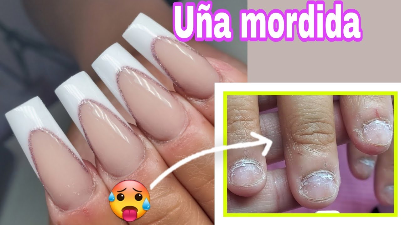 Uñas mordidas 😲| Onicofagia paso paso transformación aplicación con Tip 💅