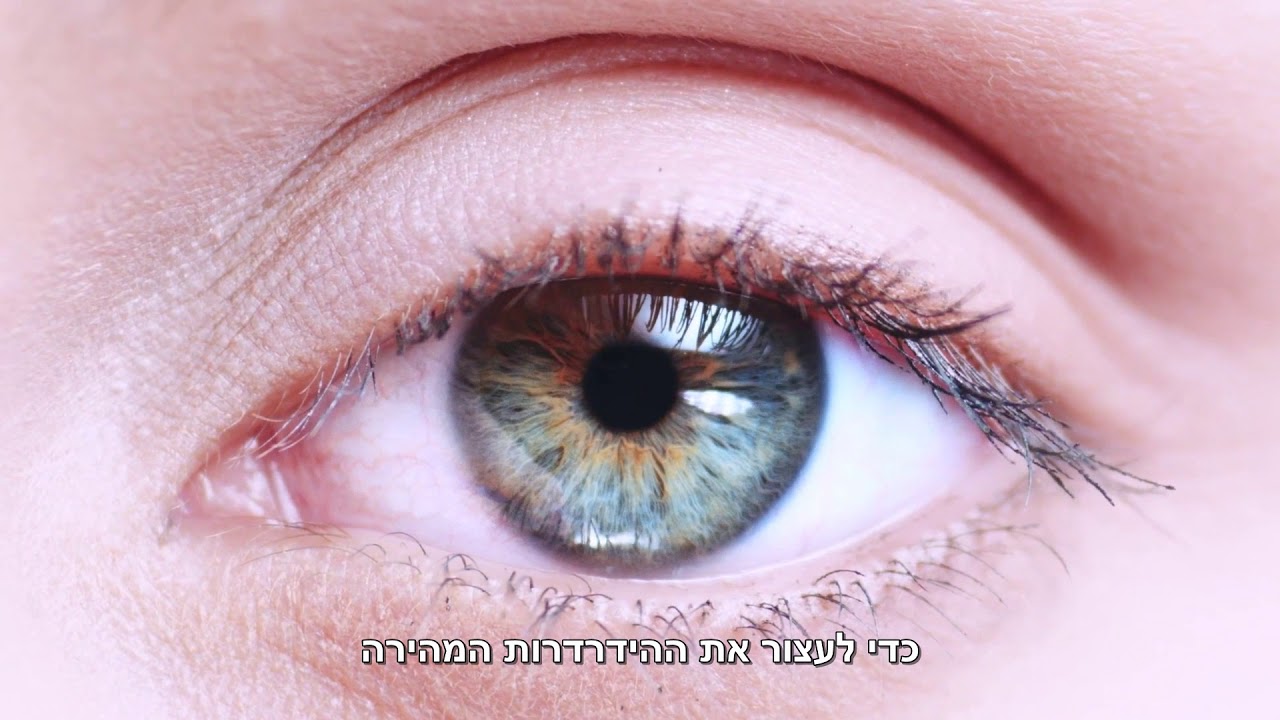 פזילה בקרב ילדים