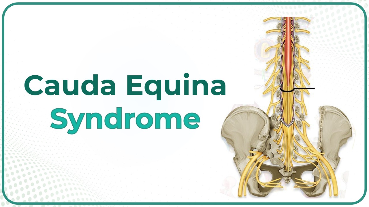 Cauda equina syndrome : Clinical anatomy : USMLE Step 1