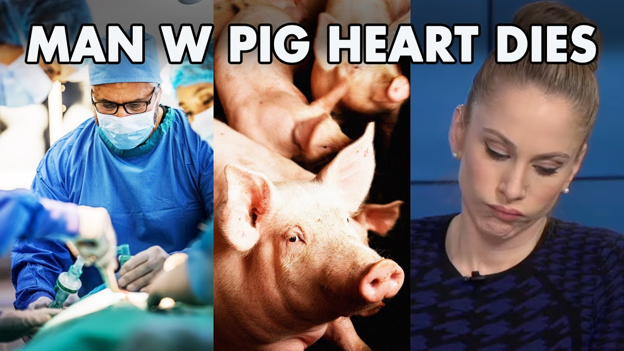 Man With Revolutionary Heart Transplant Has Died