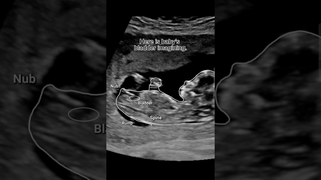 Gender Reveal by Nubx app