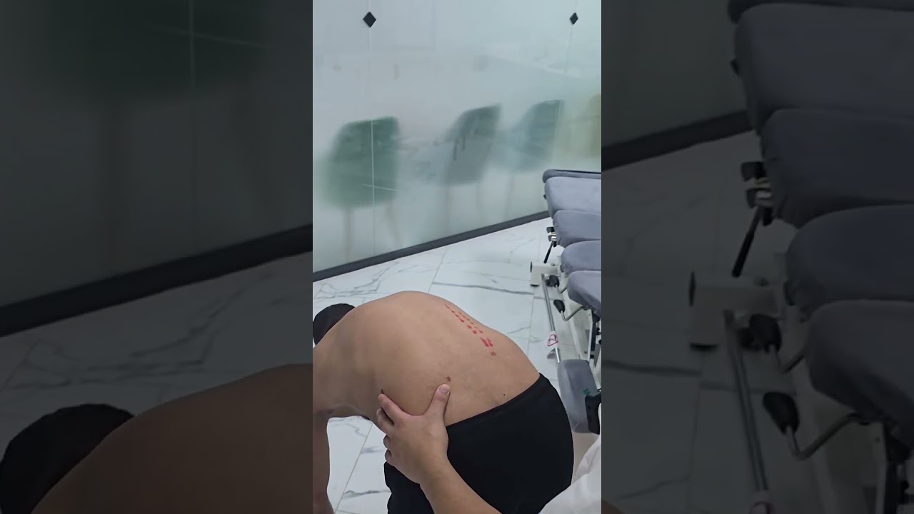 من التقييم إلى النتيجة: كيف ساعدت الأوستيوپاثي في تصحيح ميلان الحوض بطرق معتمدة وفعالة