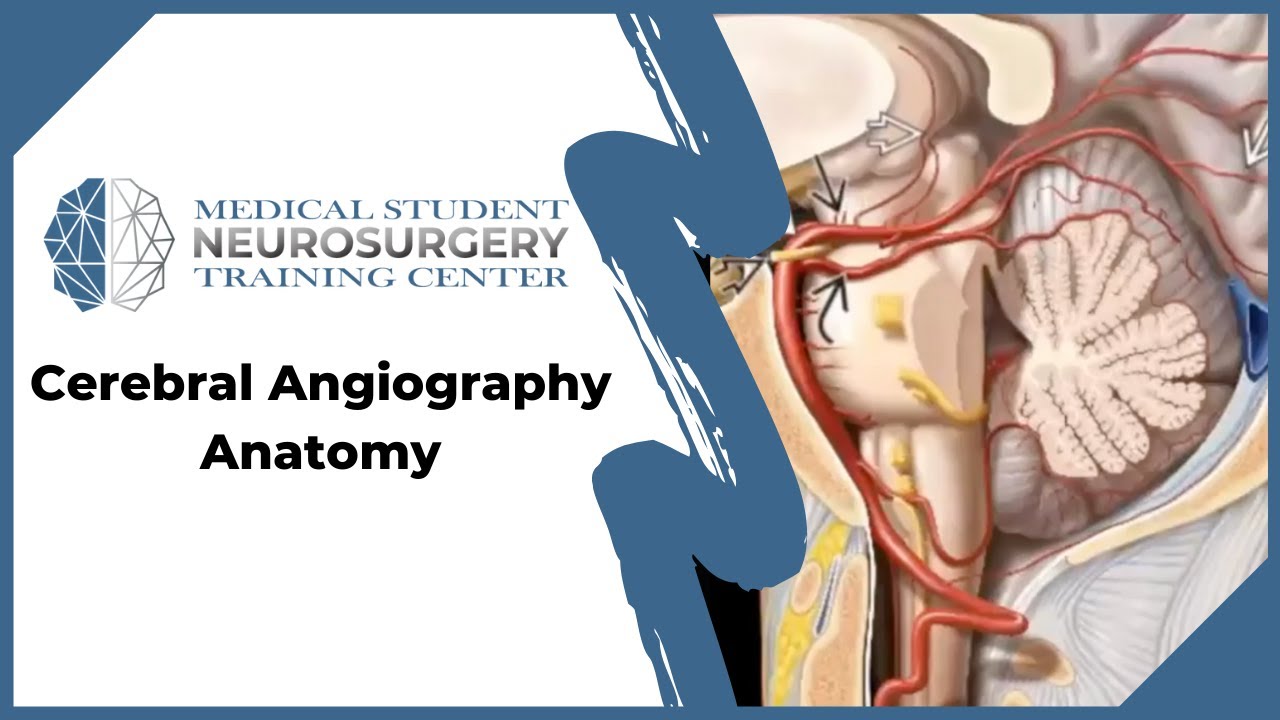 Cerebral Angiography Anatomy