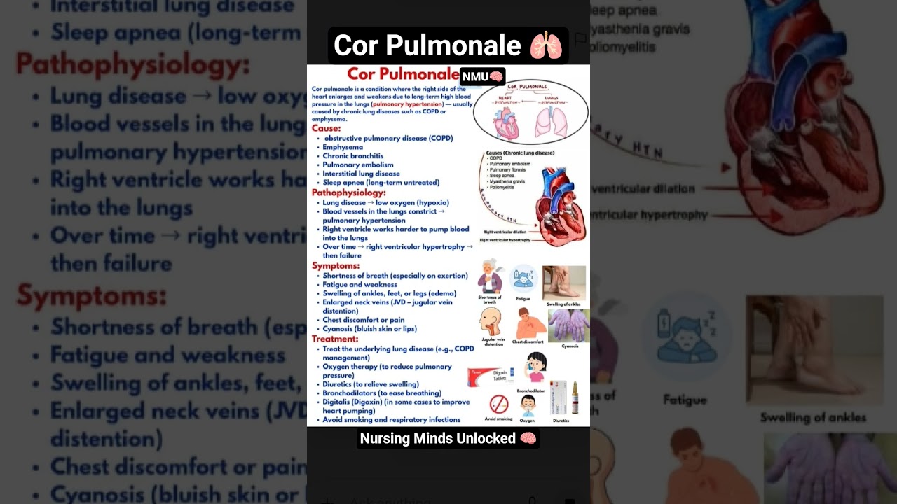 Cor Pulmonale 
