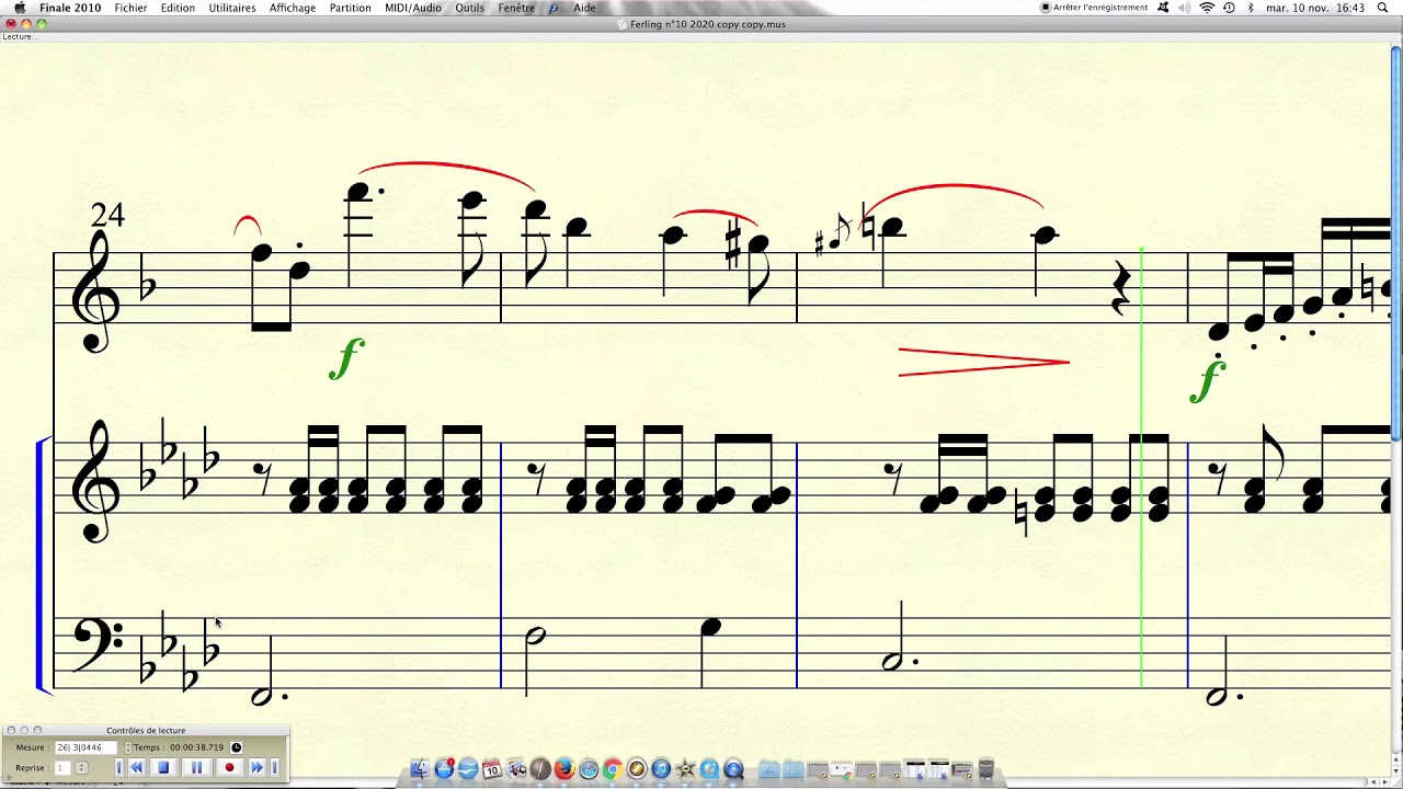 Projet FERLING Etude n°10