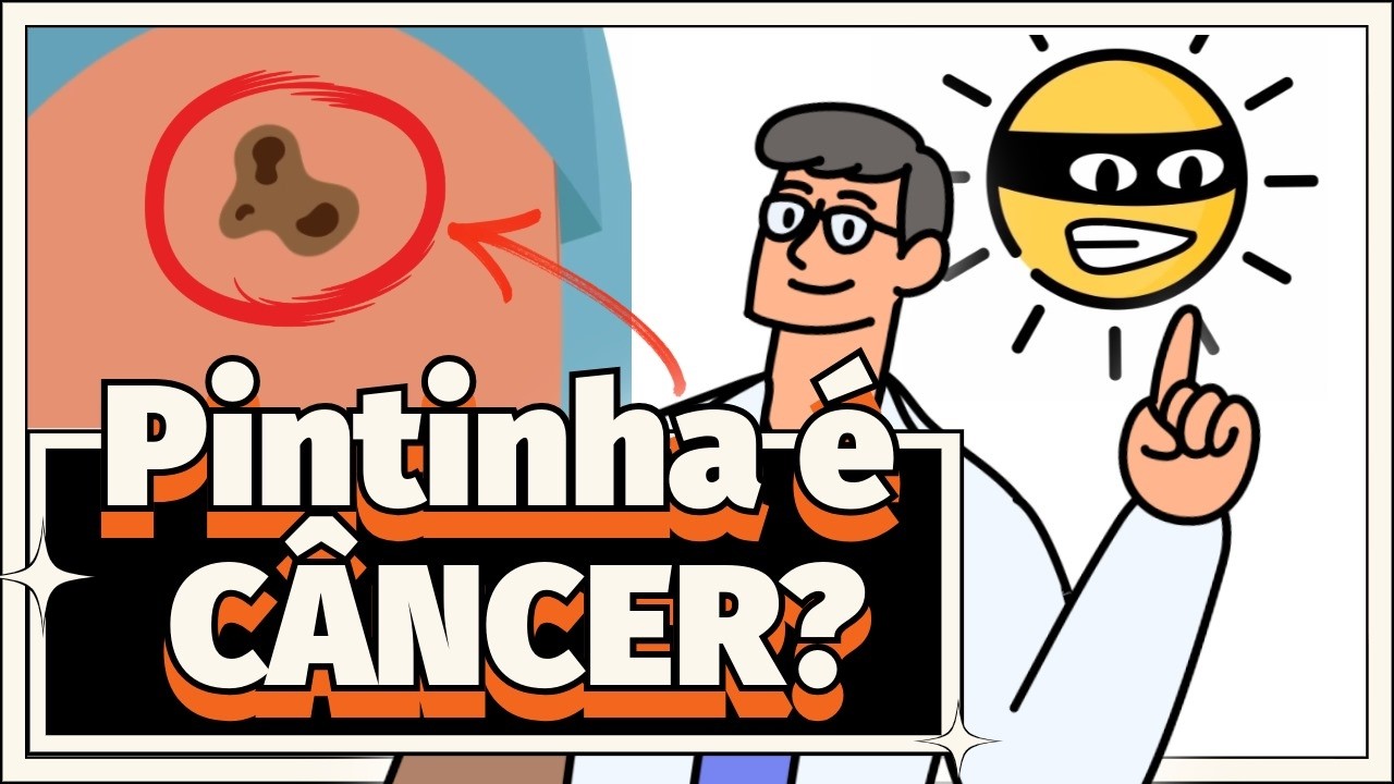 CÂNCER DE PELE: O Inimigo Dentro de Você (Tudo sobre Melanoma, CBC e CEC)!