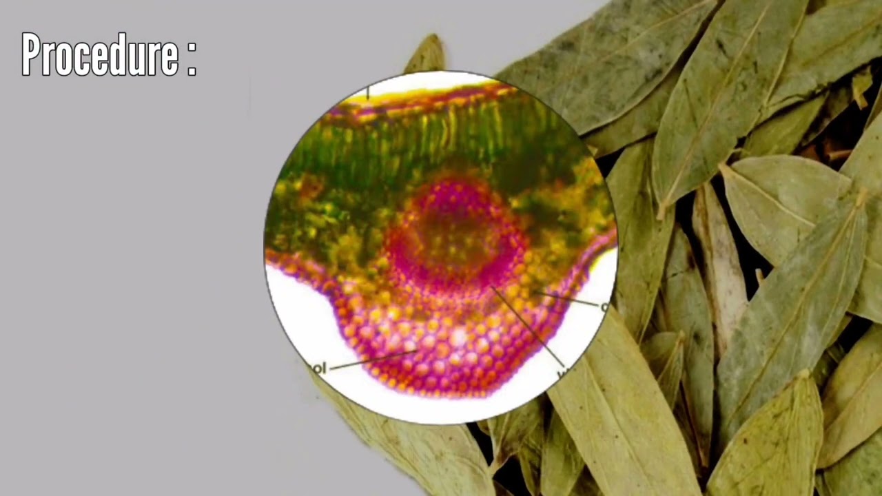 To study macroscopic and microscopy & powdered characteristics of senna By Dr. Manisha Vite