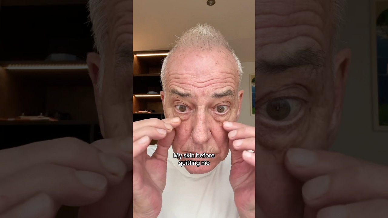 Состояние кожи после отказа от никотина 😮 