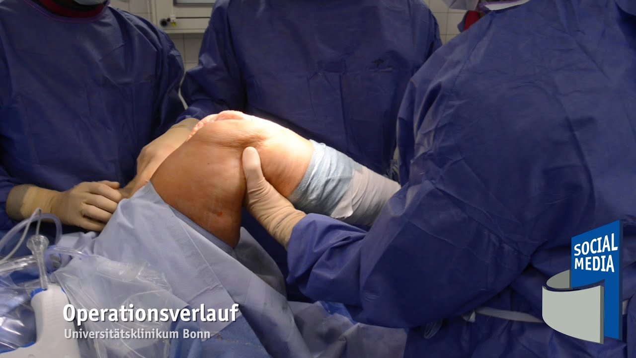 Was passiert vor, während und nach einem Kniegelenkersatz?