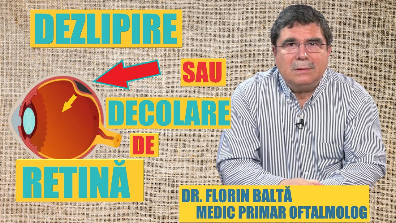 DECOLAREA RETINIANA: DR. FLORIN BALTA - MEDIC OFTALMOLOG