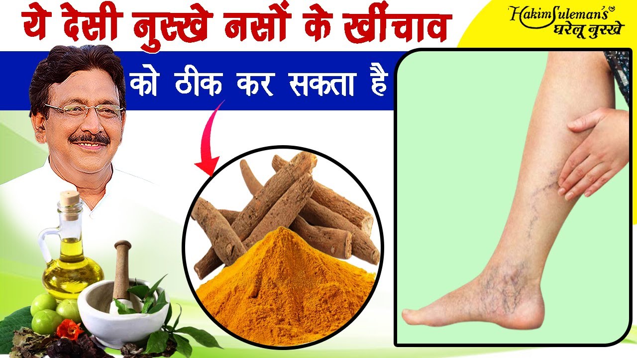 नसों के खींचाव की समस्या में फायदेमंद है ये नुस्खे। Hakeem Suleman Khan