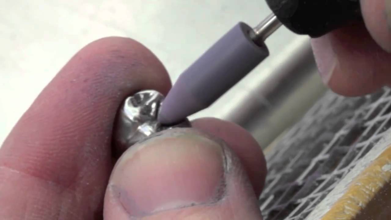 Ausarbeiten einer NEM-Krone, Politur; Trimming of a non-precious metal crown, polishing