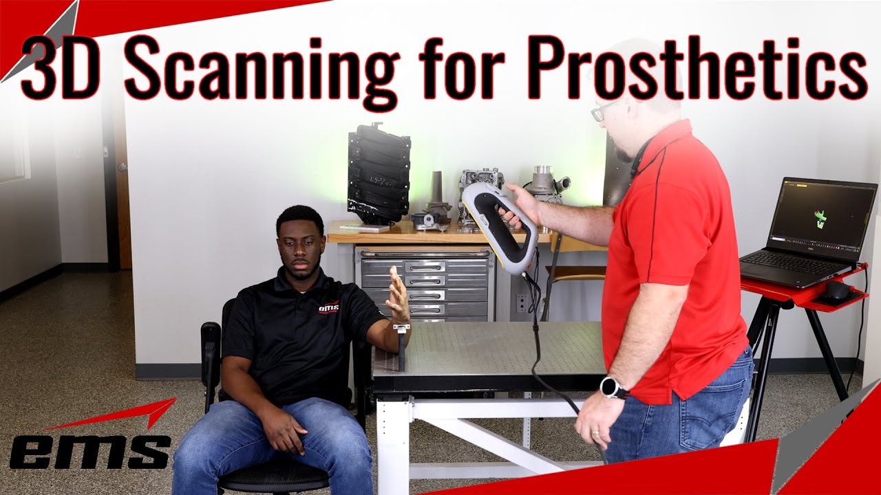 3D Scanning for Prosthetics and Braces