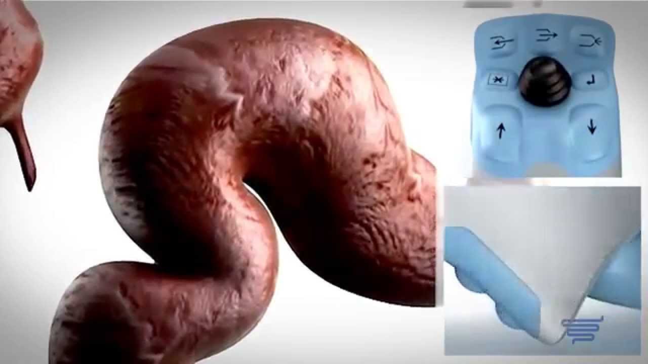 Praxisvorstellung: Gastroenterologie Dr. med. Christof Pfundstein