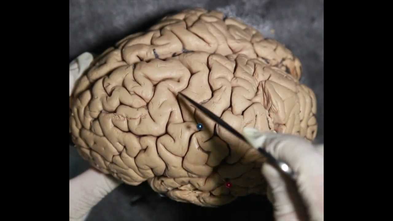 Neuroanatom&iacute;a - &Aacute;reas corticales, giros y circunvoluciones