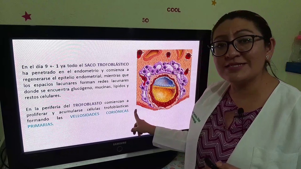 Implantaci&oacute;n