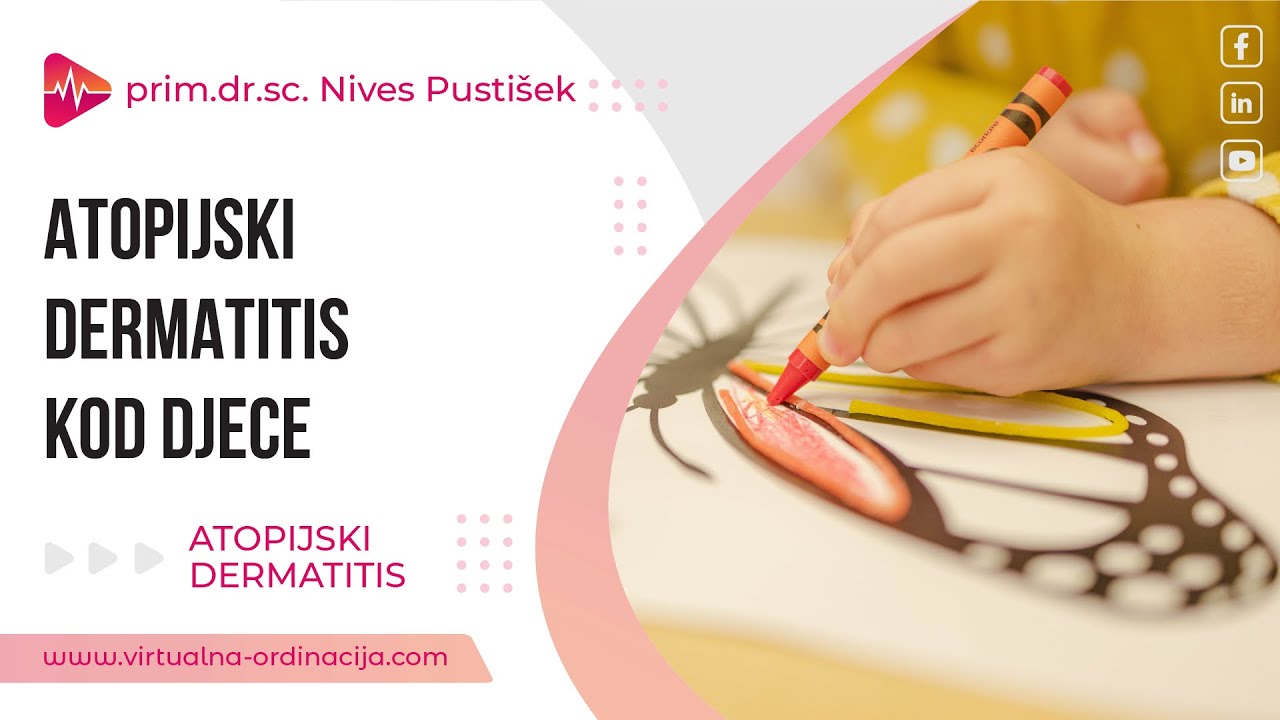 Atopijski dermatitis kod djece