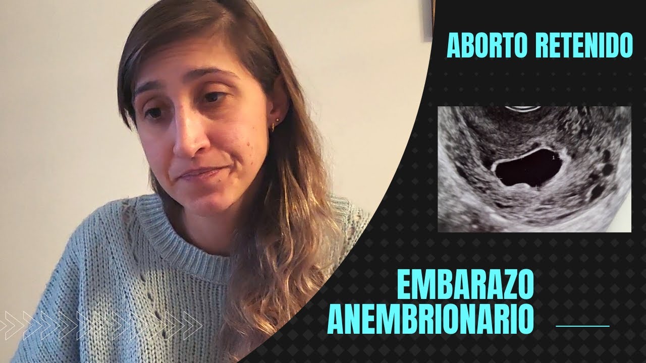 EMBARAZO ANEMBRIONARIO🤰 | ¿Dónde está mi BEBÉ? 😭