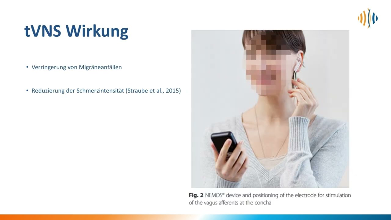 tVNS bei Migr&auml;ne
